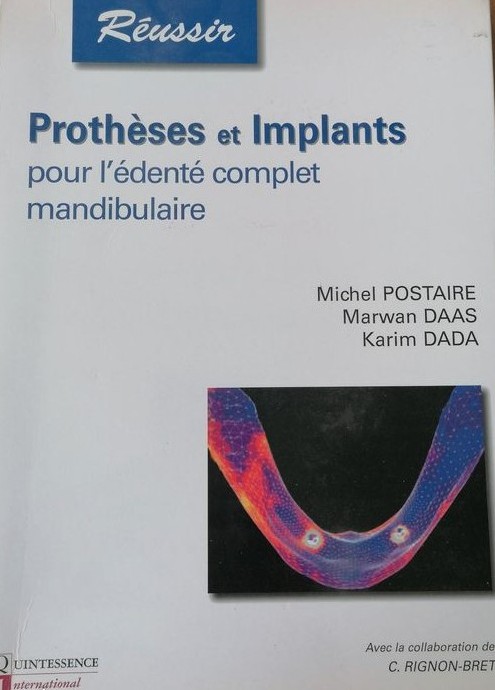 PROTHÈSES ET IMPLANTS POUR L'ÉDENTÉ COMPLET MANDIBULAIRE