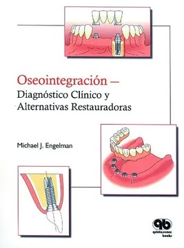 OSEOINTEGRACIÓN-DIAGNÓSTICO CLÍNICO Y ALTERNATIVAS RESTAURADORAS