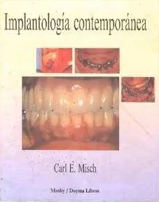 IMPLANTOLOGÍA CONTEMPORÁNEA