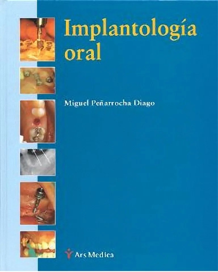 IMPLANTOLOGIA ORAL