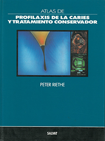 ATLAS DE PROXILAXIS DE LA CARIES Y TRATAMIENTO CONSERVADOR