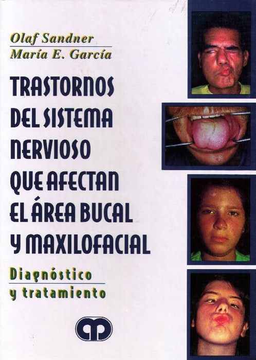 TRASTORNOS DEL SISTEMA NERVIOSO QUE AFECTAN EL ÁREA BUCAL Y MAXILOFACIAL. DIAGNÓSTICO Y TRATAMIENTO.