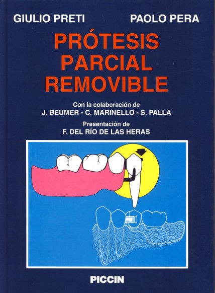 PRÓTESIS PARCIAL REMOVIBLE