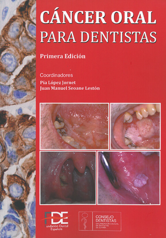 CÁNCER ORAL PARA DENTISTAS 1ª EDICIÓN