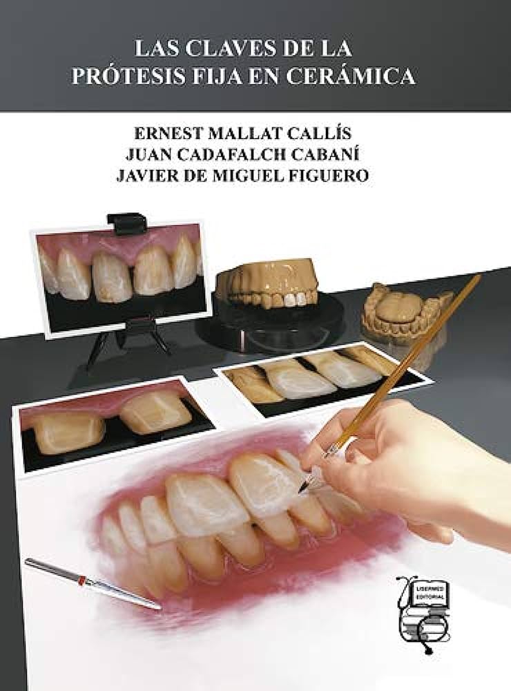 LAS CLAVES DE LA PRÓTESIS FIJA EN CERÁMICA