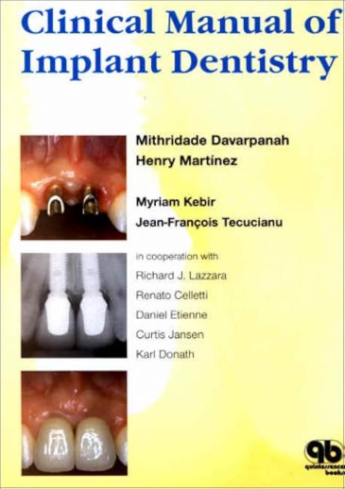 CLINICAL MANUAL OF IMPLANT DENTISTRY