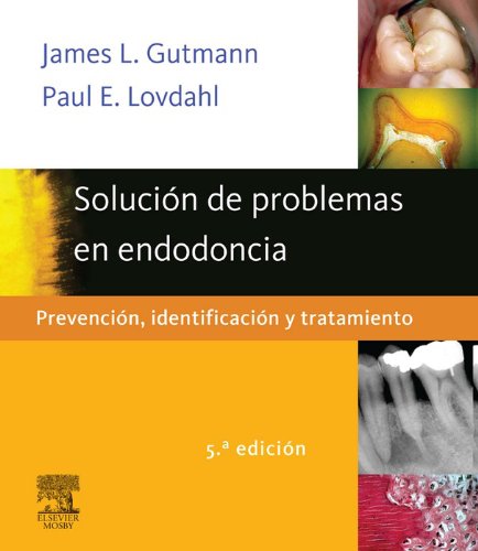 SOLUCIÓN DE PROBLEMAS EN ENDODONCIA: PREVENCIÓN, IDENTIFICACIÓN Y TRATAMIENTO