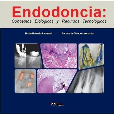 ENDODONCIA. CONCEPTOS BIOLÓGICOS Y RECURSOS TECNOLÓGICOS.