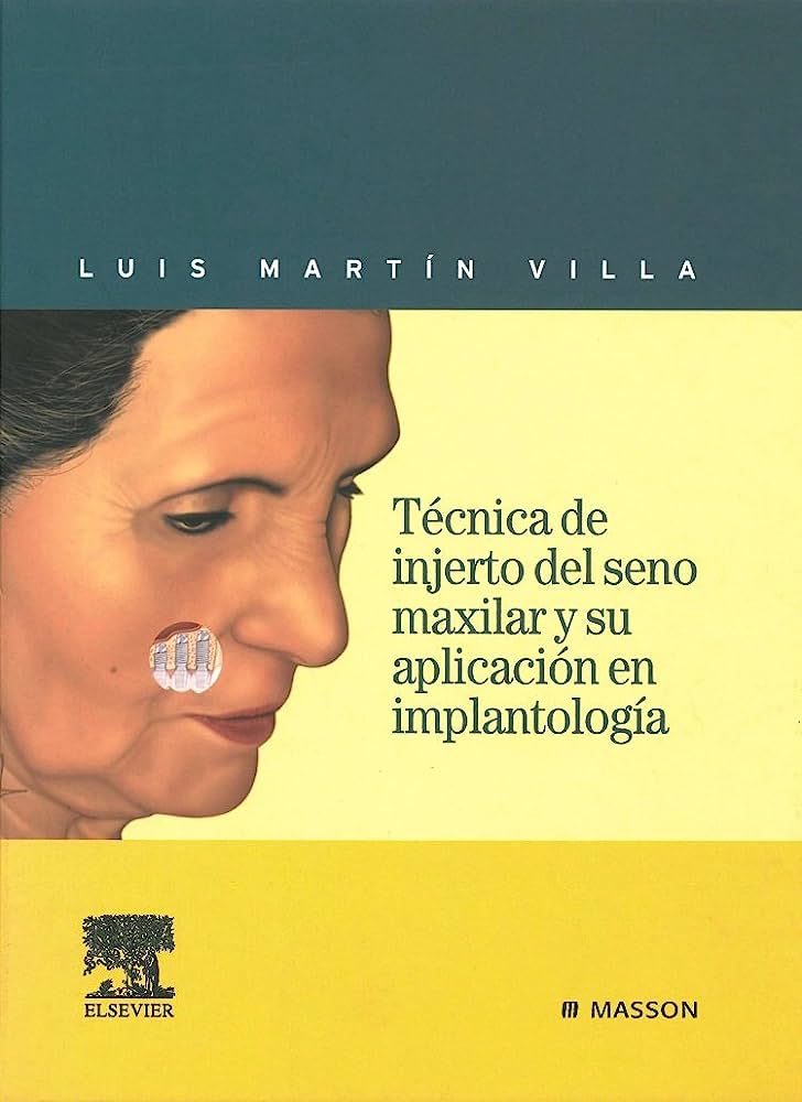 TÉCNICA DE INJERTO DEL SENO MAXILAR Y SU APLICACIÓN EN IMPLANTOLOGÍA