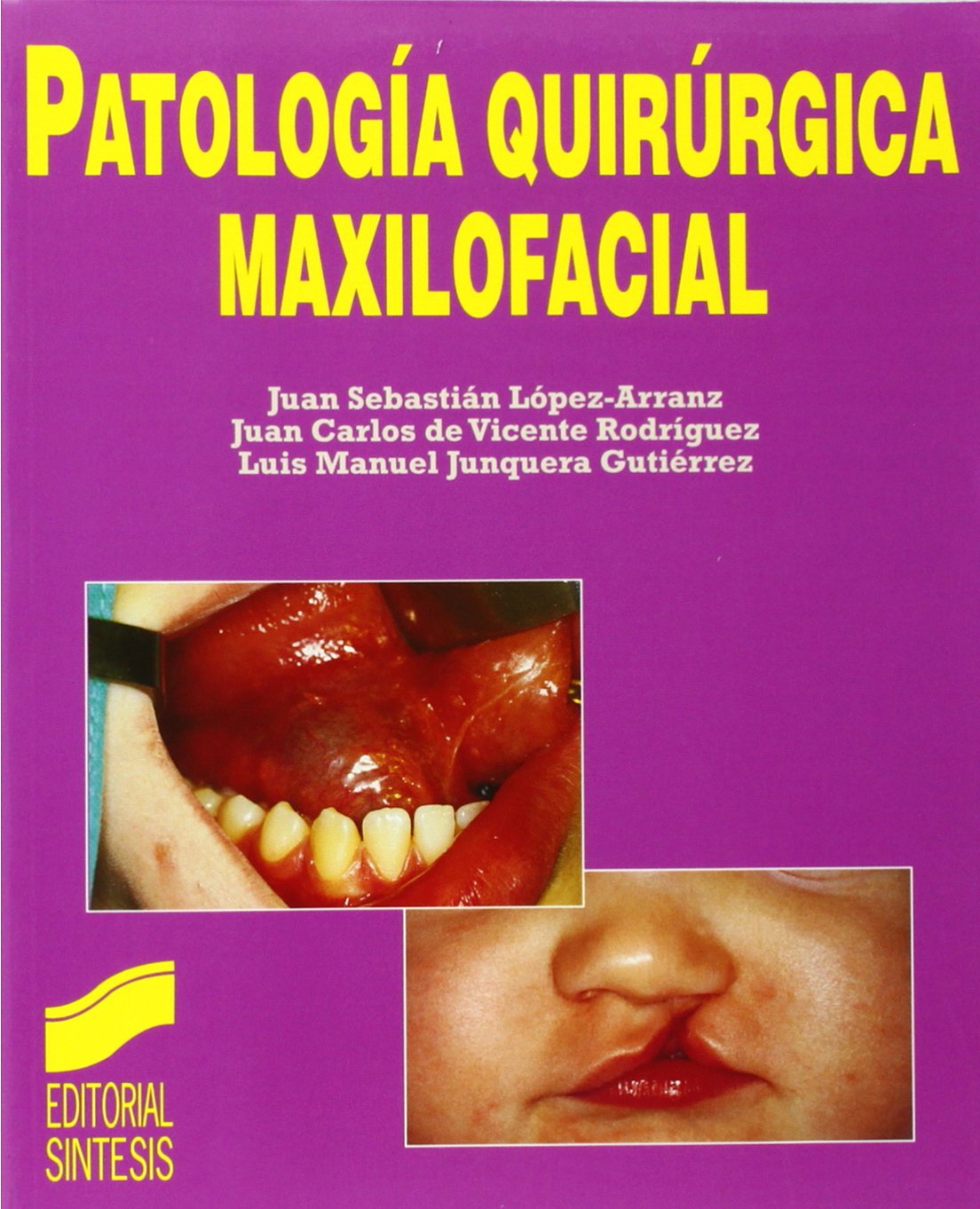 PATOLOGÍA QUIRÚRGICA MAXILOFACIAL