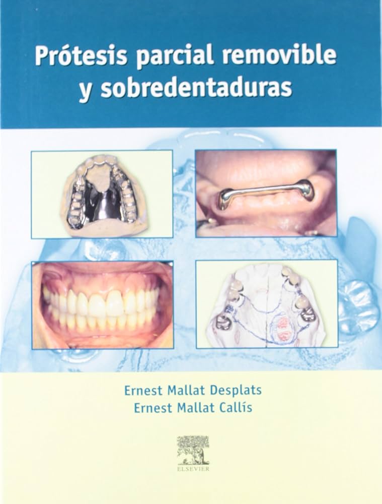 PRÓTESIS PARCIAL REMOVIBLE Y SOBREDENTDURAS