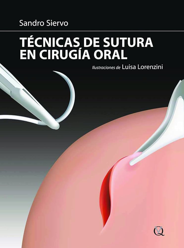 TÉCNICAS DE SUTURA EN CIRUGÍA ORAL