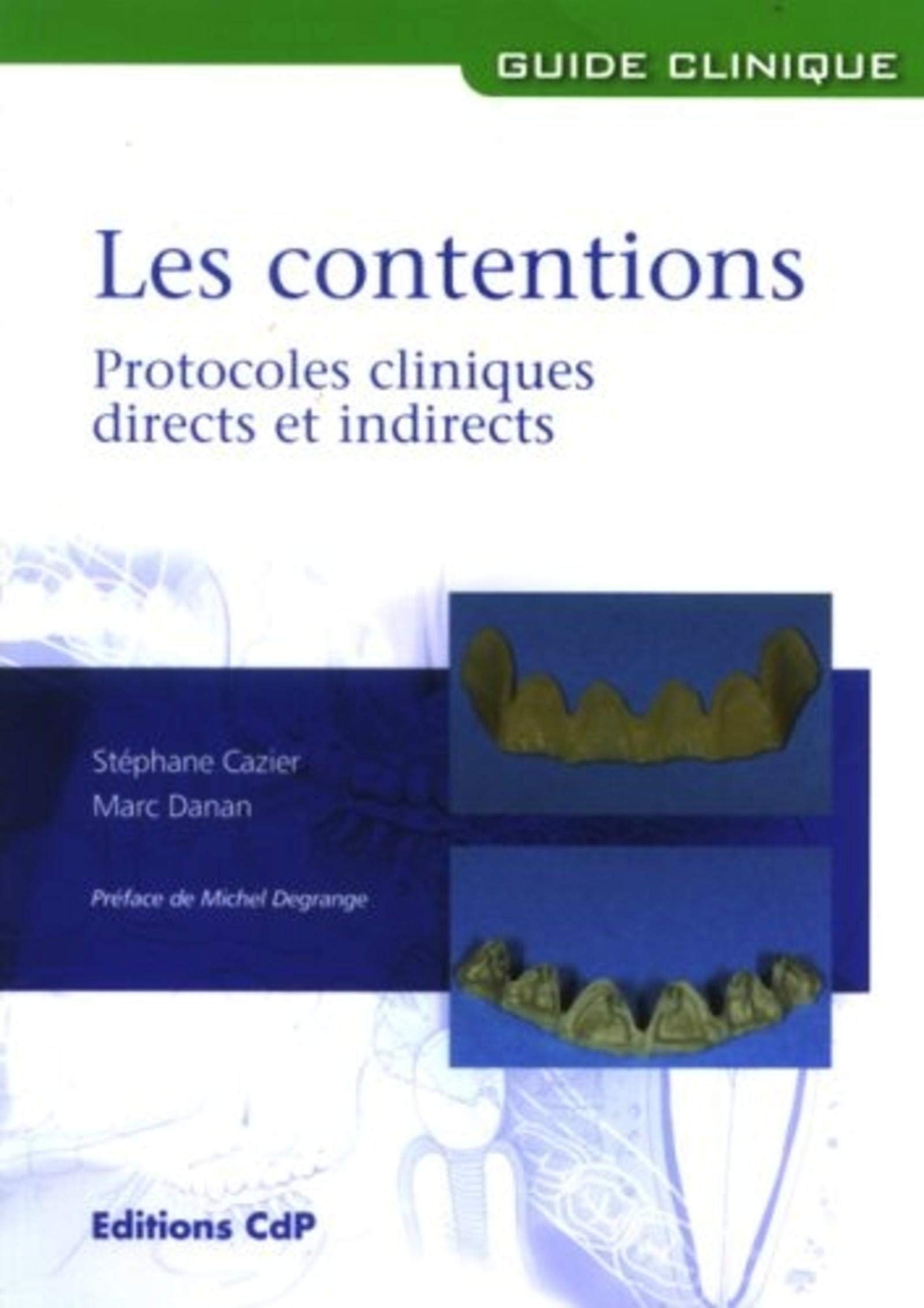 LES CONTENTIONS. PROTOCOLES CLINIQUES DIRECTS ET INDIRECTS.