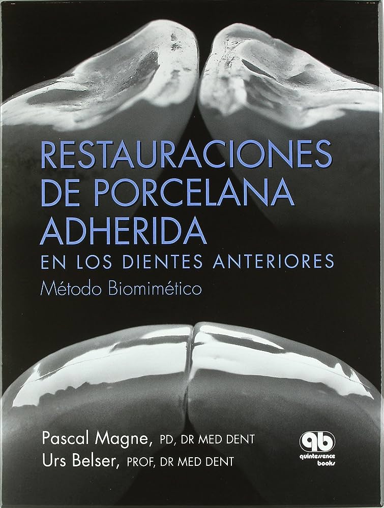 RESTAURACIONES DE PORCELANA ADHERIDA EN LOS DIENTES ANTERIORES