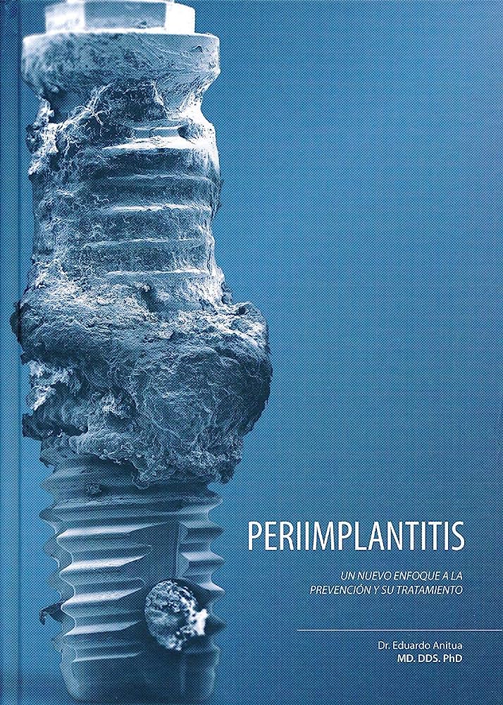 PERIIMPLANTITIS: UN NUEVO ENFOQUE A LA PREVENCIÓN Y SU TRATAMIENTO