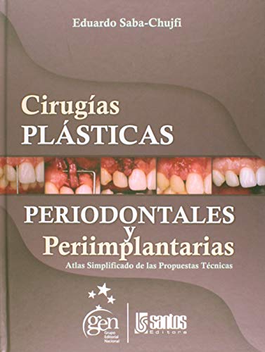 CIRUGÍAS PLÁSTICAS PERIODONTALES Y PERIIMPLANTARIAS. ATLAS SIMPLIFICADO DE LAS PROPUESTAS TÉCNICAS.