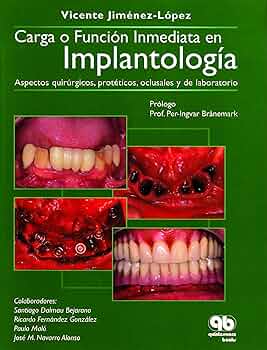 CARGA O FUNCIÓN INMEDIATA EN IMPLANTOLOGÍA. ASPECTOS QUIRÚRGICOS, PROTÉTICO, OCLUSALES Y DE LABORATORIO.