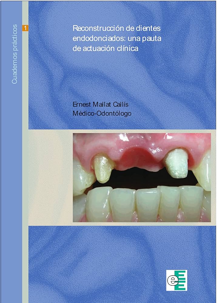 RECONSTRUCCIÓN DE DIENTES ENDODONCIADOS: UNA PAUTA DE ACTUACIÓN CLÍNICA