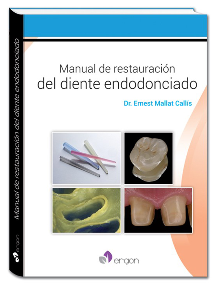 MANUAL DE RESTAURACIÓN DEL DIENTE ENDODONCIADO