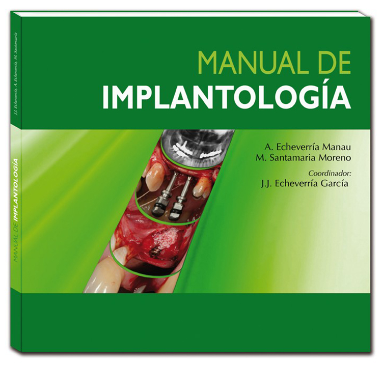 MANUAL DE IMPLANTOLOGÍA