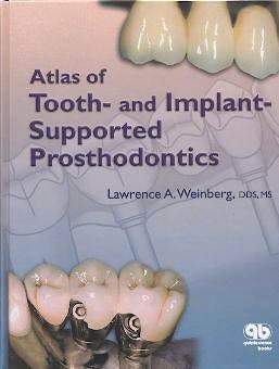 ATLAS OF TOOTH-AND IMPLANT- SUPPORTED PROSTHODONTICS
