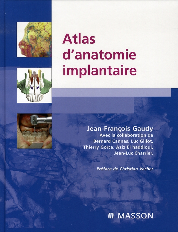 ATLAS D'ANATOMIE IMPLANTAIRE