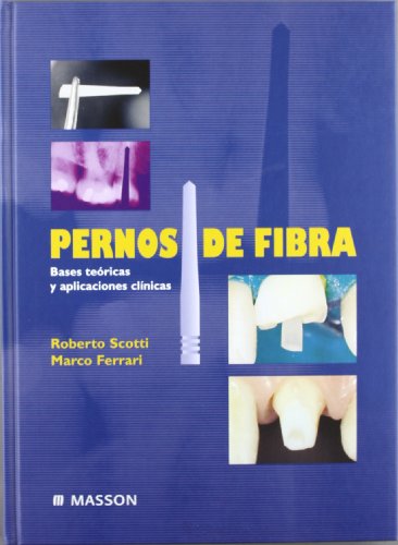 PERNOS DE FIBRA. BASES TEÓRICAS Y APLICACIONES CLÍNICAS
