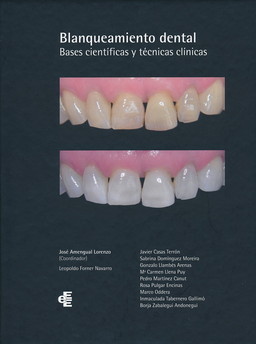 BLANQUEAMIENTO DENTAL. BASES CIENTÍFICAS Y TÉCNICAS CLÍNICAS.