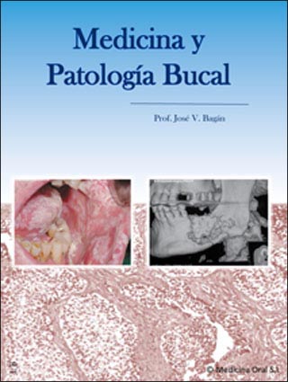 MEDICINA Y PATOLOGÍA BUCAL