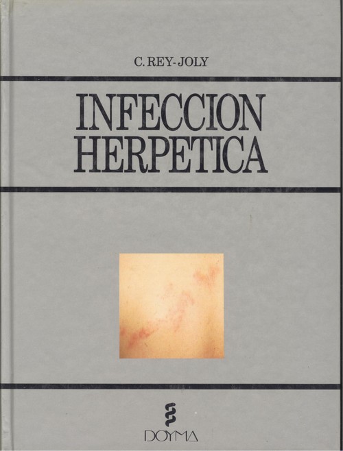 INFECCIÓN HERPÉTICA
