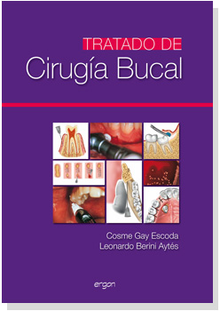 TRATADO DE CIRUGÍA BUCAL