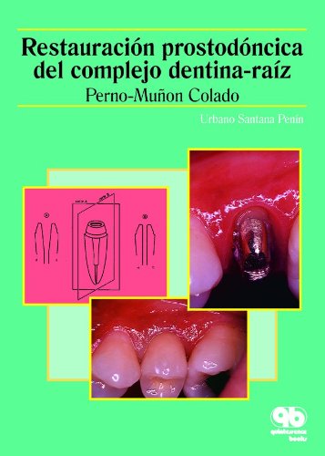 RESTAURACIÓN PROSTODÓNCICA DEL COMPLEJO DENTINA-RAÍZ. PERNO-MUÑON COLADO