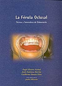 LA FÉRULA OCLUSAL. TÉCNICA Y SISTEMÁTICA DE ELABORACIÓN.