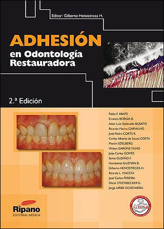 ADHESIÓN EN ODONTOLOGÍA RESTAURADORA