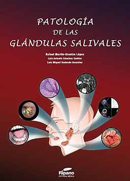 PATOLOGÍA DE LAS GLÁNDULAS SALIVALES