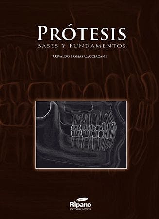 PRÓTESIS. BASES Y FUNDAMENTOS.