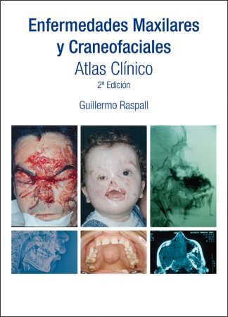 ENFERMEDADES MAXILARES Y CRANEOFACIALES ATLAS CLÍNICO 2º EDICIÓN