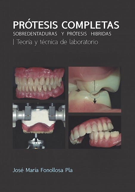 PRÓTESIS COMPLETAS SOBREDENTADURAS Y PRÓTESIS HIBRIDAS: TEORÍA Y TÉCNICA DE LABORATORIO