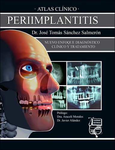 ATLAS CLÍNICO PERIIMPLANTITIS. NUEVO ENFOQUE DIAGNÓSTICO CLÍNICO Y TRATAMIENTO.