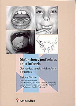 DISFUNCIONES OROFACIALES EN LA INFANCIA. DIAGNÓSTICO, TERAPIA MIOFUNCIONAL Y LOGOPEDIA