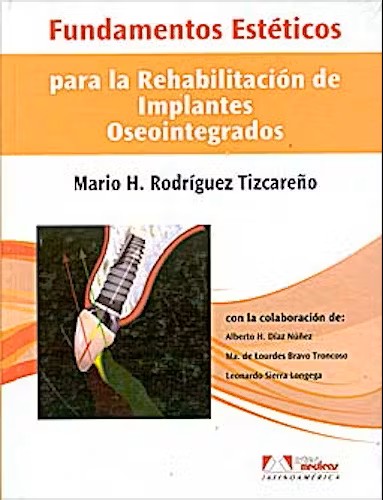 FUNDAMENTOS ESTÉTICOS PARA LA REHABILITACIÓN DE IMPLANTES OSEOINTEGRADOS