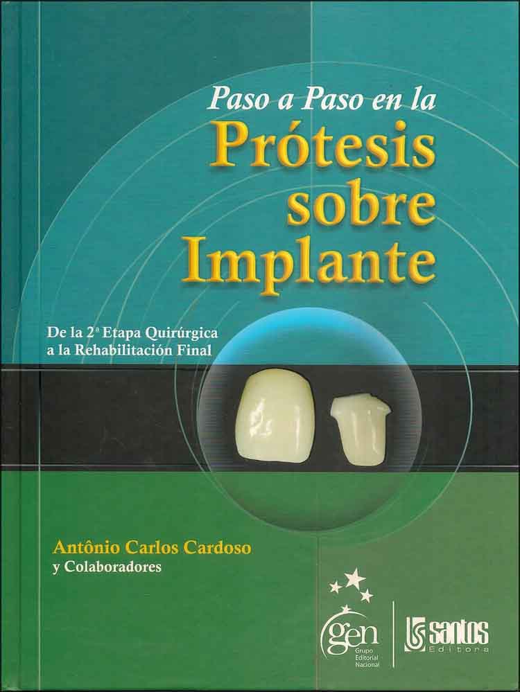 PASO A PASO EN LA PRÓTESIS SOBRE IMPLANTE