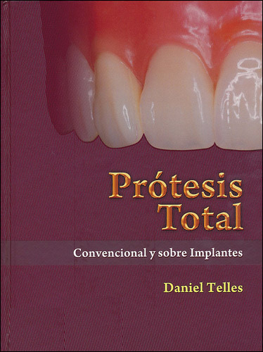 PRÓTESIS TOTAL: CONVENCIONAL Y SOBRE IMPLANTES