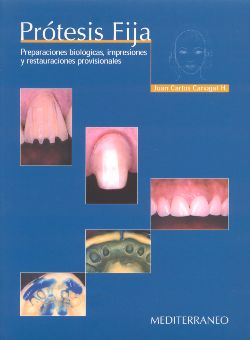 PRÓTESIS FIJA. PREPARACIONES BIOLÓGICAS, IMPRESIONES Y RESTAURACIONES PROVISIONALES.