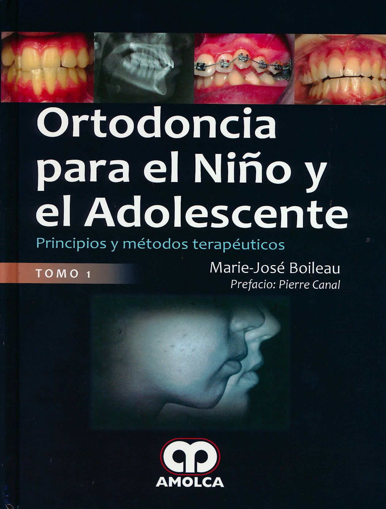 ORTODONCIA PARA EL NIÑO Y EL ADOLESCENTE: PRINCIPIOS Y MÉTODOS TERAPÉUTICOS TOMO I