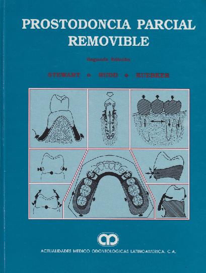 PROSTODONCIA DENTAL PARCIAL REMOVIBLE