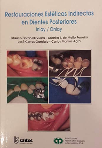 RESTAURACIONES ESTÉTICAS INDIRECTAS EN DIENTES POSTERIORES INLAY / ONLAY