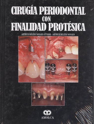 CIRUGÍA PERIODONTAL CON FINALIDAD PROTÉSICA