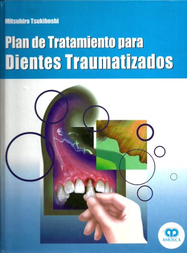 PLAN DE TRATAMIENTO PARA DIENTES TRAUMATIZADOS