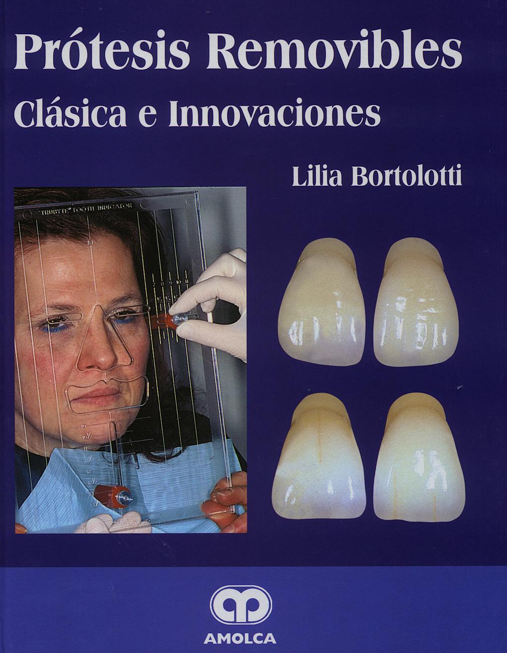 PRÓTESIS REMOVIBLES. CLÁSICAS E INNOVACIONES.